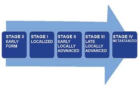 Stages of Cancer