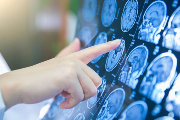 stereotactic-radiosurgery (1)